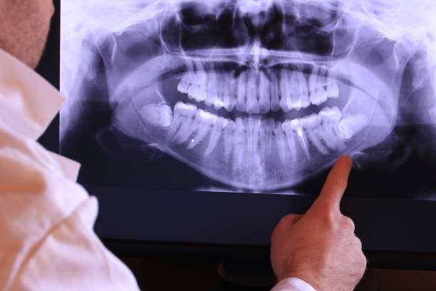 Best Emergency Tooth Extraction  in Middlefield, OH